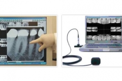Digital X-Ray for Immediate safe & Accurate Dental X-Rays
